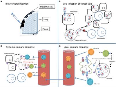 Oncolytic Viral Therapy for Mesothelioma